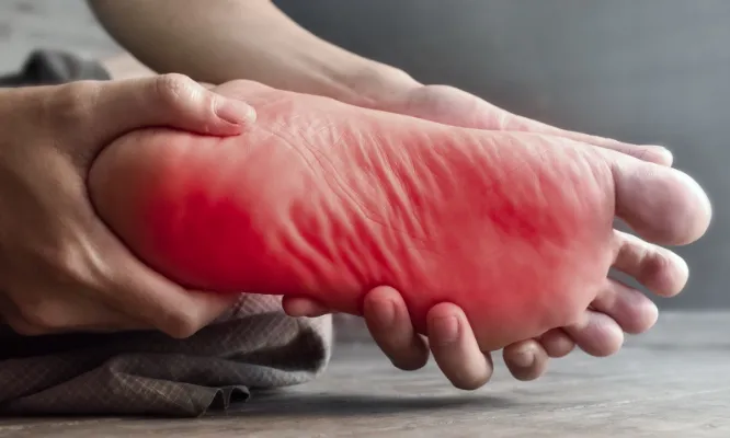 Plantar fasciitis demostration