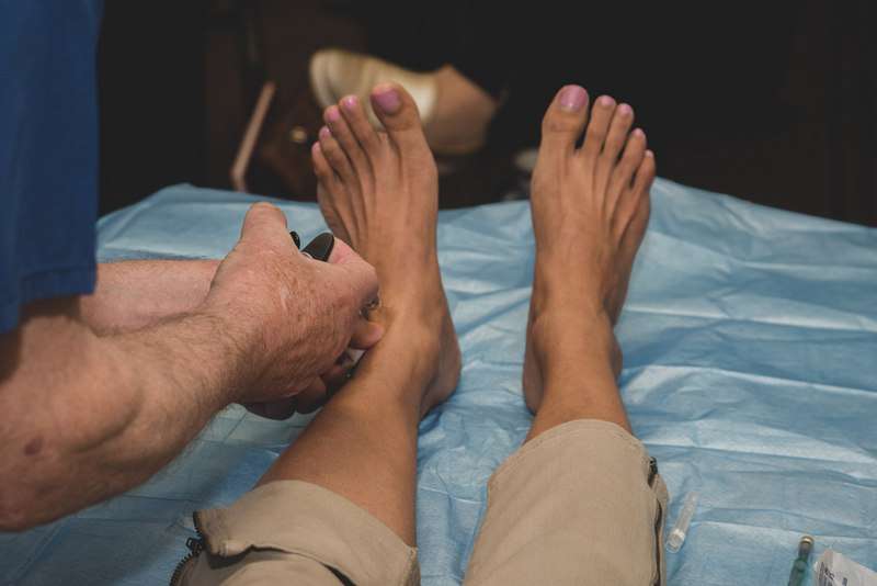 Posterior-Tibial-Tendonitis-PRP-Injections