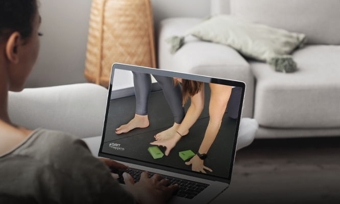 legs with bunions