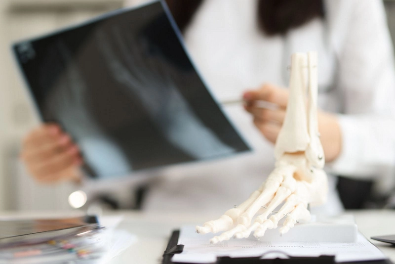 Diagnosing Midfoot Sprains