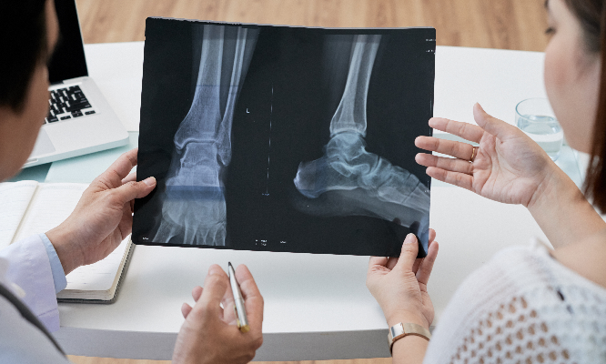 x-ray of feet with toe bunions