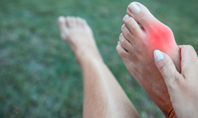 symptoms of bunions