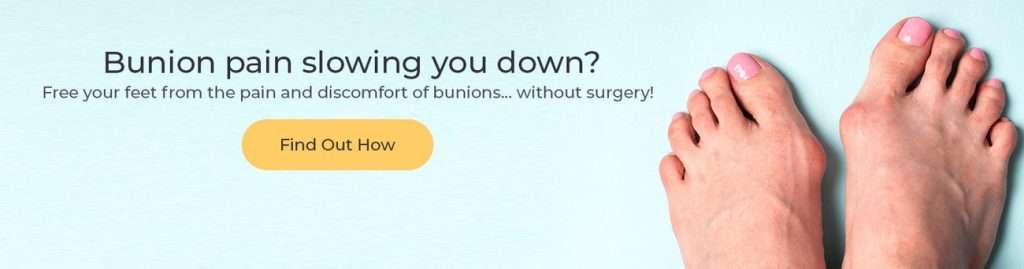 Bunion Treatment Banner