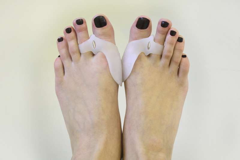 Can toe spacers help bunions?